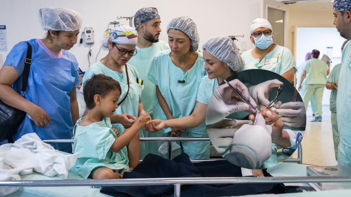 114 niños recibieron operaciones de reconstrucción gratuitas en Medellín para eliminar la continuación del trauma en sus manos

 – En la mira