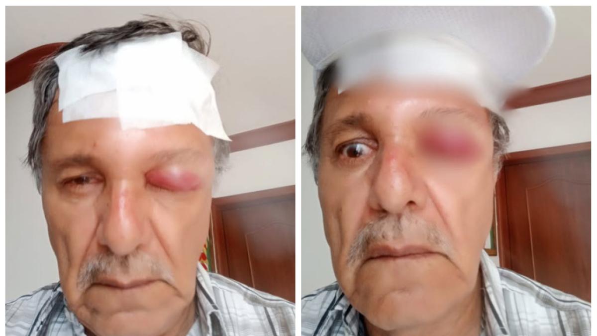 De esta manera, el caso del camarógrafo atacó en absoluto

 – En la mira