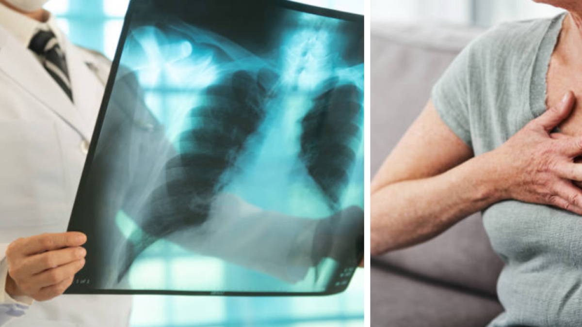 Dadis informa más de 300 casos de tuberculosis hasta 2025.

 – En la mira