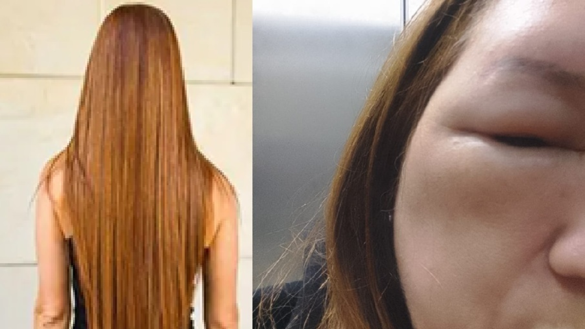 su cráneo y su cara estaban hinchados

 – En la mira