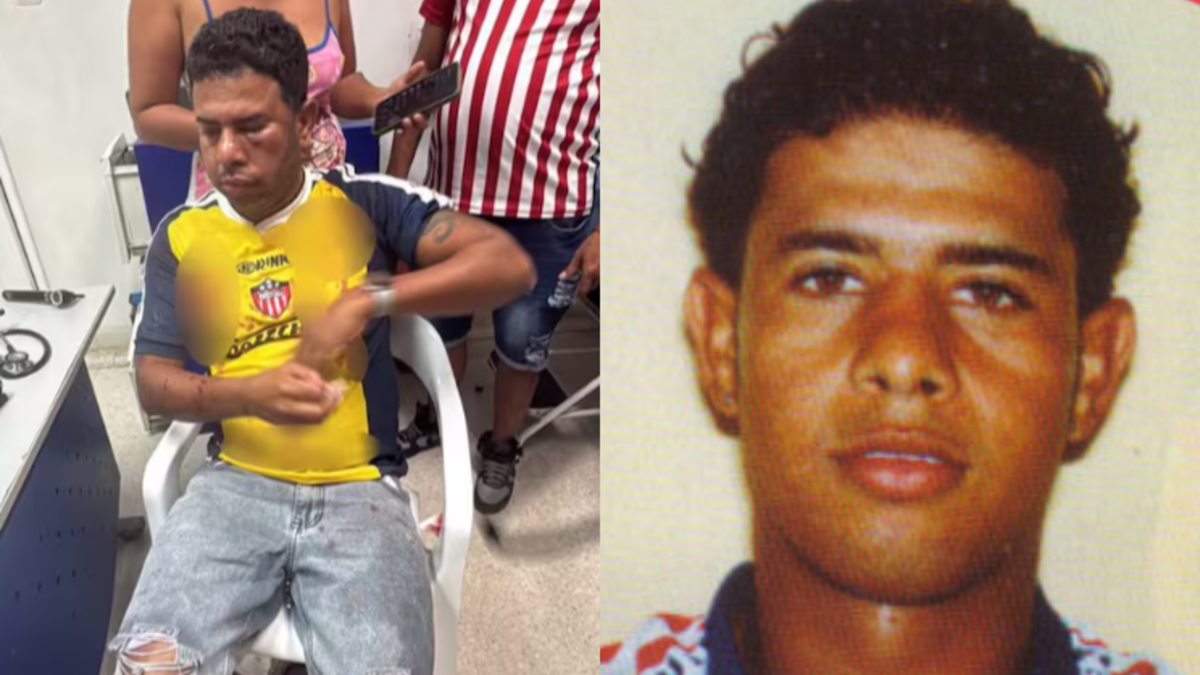 Daniel Machacón, exjugador junior, se recupera de una lesión durante una trifulca en Suan

 – En la mira