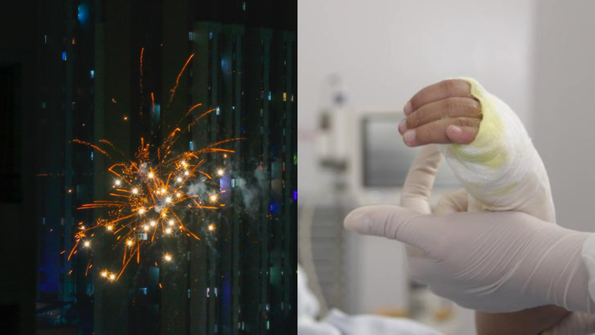 Un joven de 18 años perdió los dedos

 – En la mira