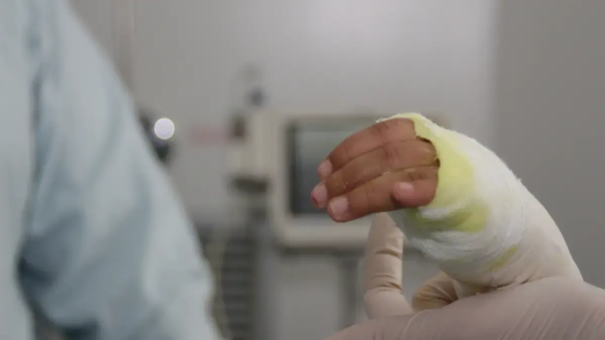 Un menor de ocho años se encuentra en la UCI debido a graves quemaduras por gasolina recibida en su cuerpo.

 – En la mira