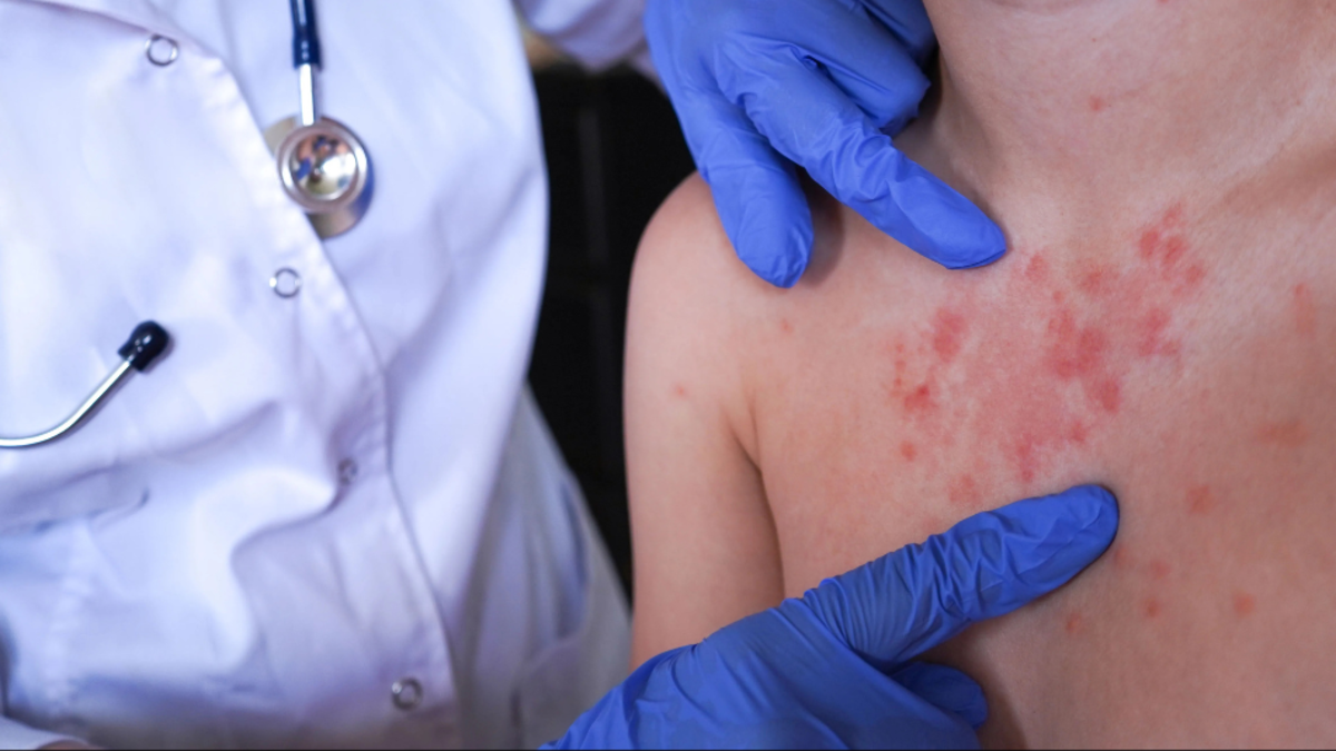 El gobierno pide actualizar programas de vacunación para casos importados en Bogotá y Bucaramanga

 – En la mira