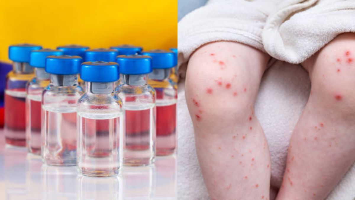 La Secretaría Regional de Salud espera respuesta del Gobierno al pedido de 20.000 dosis

 – En la mira