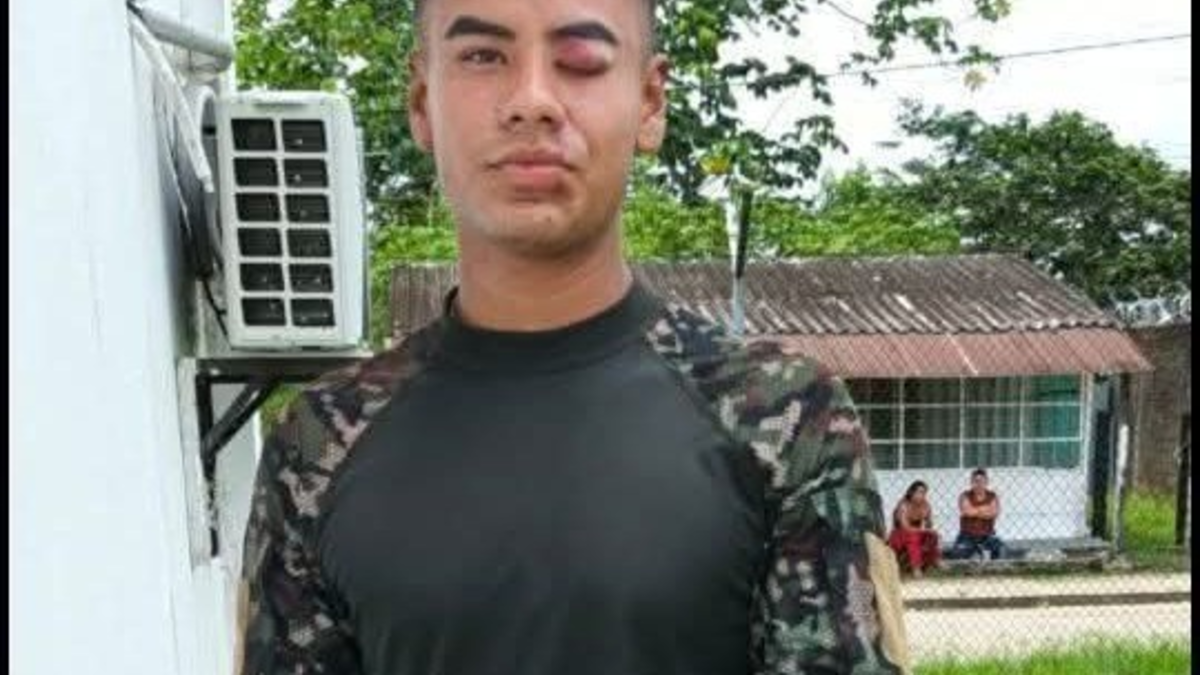 un desgarrador testimonio de uno de los 57 sobrevivientes del accidente del Hércules en Putumayo

 – En la mira